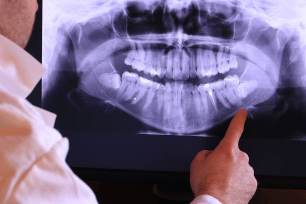 Best Emergency Dental Care for Broken or Chipped Teeth in West Carrollton, OH
