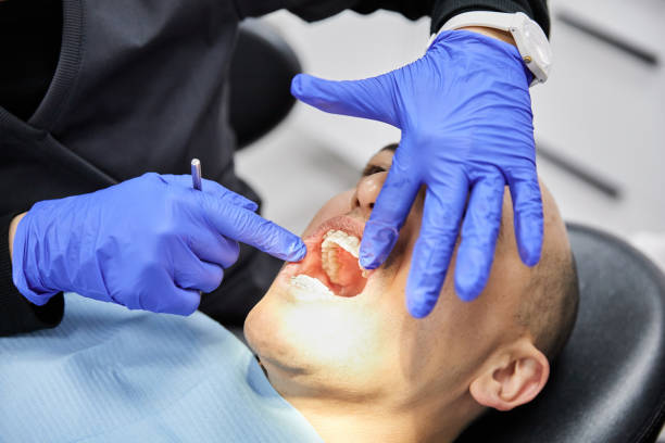 Best Emergency Treatment for Dental Infections or Abscesses in West Carrollton, OH